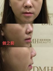 -东莞缔美美容医院