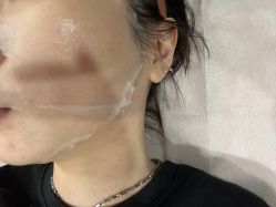 体验后-北京炫美医疗美容