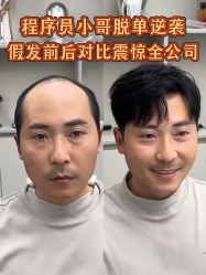 -唐风采假发补发定制