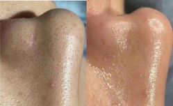 -美肤盾祛痘·问题肌头疗管理中心