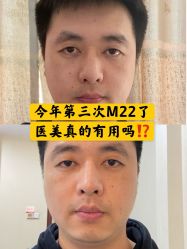 -小忠丽格医美