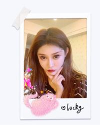 体验后-大麦微针植发全国连锁