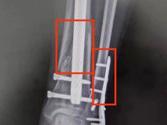 -上海市第一人民医院(松江南部)