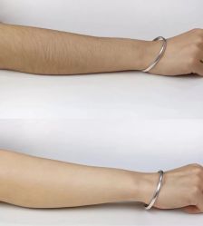 -薇兰专业脱毛连锁机构