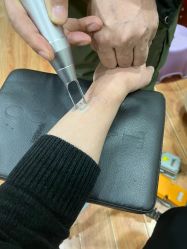 -一次性洗纹身·修复疤痕·超皮秒