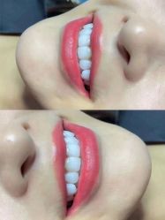 点击看大图 -美朵纹绣美牙纹眉工作室