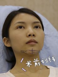 -广东韩妃整形外科医院