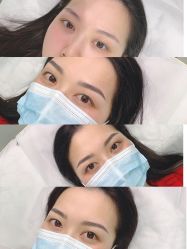 -久匠半永久纹眉