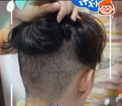 -大麦微针植发全国连锁