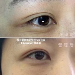 -E.beauty驻颜·痘敏肌调理中心