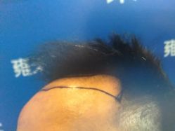 -雍禾植发全国连锁