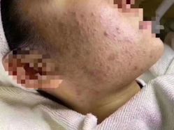-慕拉美甲美睫皮肤管理