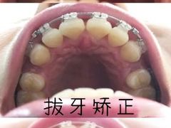 -团圆口腔·种植中心(锦江院区)