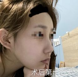 -西安壹加壹医疗美容·西北抗衰旗舰店