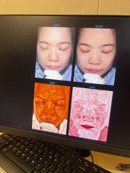 -雪纤瘦美容中心