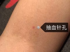 -浙江省中医院(湖滨院区)