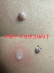 -智丽佳人祛斑祛痘美容美体