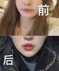 -上海漾颜医疗美容