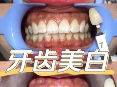 -Dr.Z dental仁康种植矫正中心