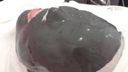 -悦己医疗美容整形线雕提升专门店