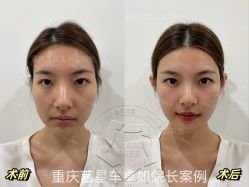 点击看大图 -Yestar重庆艺星医疗美容医院