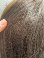 -熙朵美学植发·连锁品牌