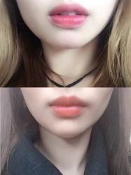 体验前-洁铭新加坡医美