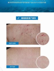 -苗方清颜痘肌研究所