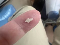 -世龙世家灰指甲鸡眼脚气甲沟炎跖疣护理(通州店)