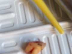 -上海仁爱医院口腔科 · 种植
