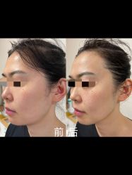 -MUFI·美悦菲塑颜美容SPA