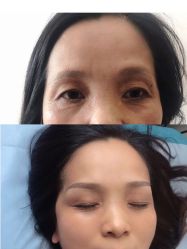 -久匠半永久纹眉