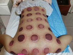 -益友堂盲人推拿正骨穴位按摩工作室