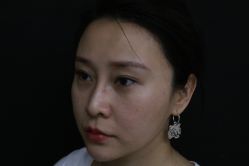 -深圳春天阳光医院·轮廓抗衰中心