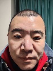 体验前-丽都整形美容医院·全国连锁旗舰店