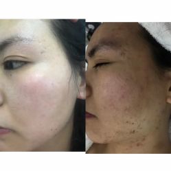 -痘庄科学祛痘国际连锁