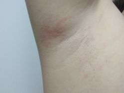 -晶奕空间专业脱毛连锁机构