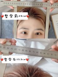 -FACE·日本小颜矫正美容整骨サロン