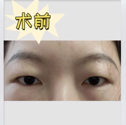 -素美医疗美容·西南眼鼻整形·修复基地