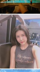 -大麦微针植发丨全国连锁