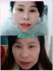 -广东韩妃整形外科医院
