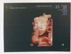 -杭州贝瑞斯美华妇儿医院·早孕·产检·儿科