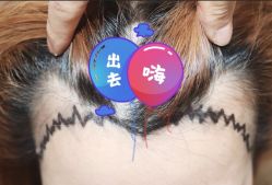 -大麦微针植发全国连锁