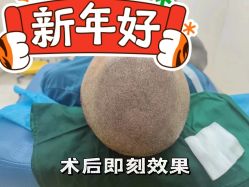 -熙朵美学植发连锁