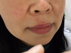 -痣清宫祛斑祛痣连锁店