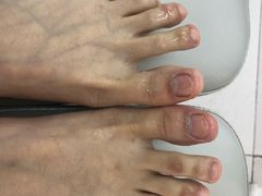 -新甲连锁灰指甲·甲沟炎·鸡眼(黑龙江路店)