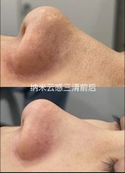-SKIN79皮肤管理中心