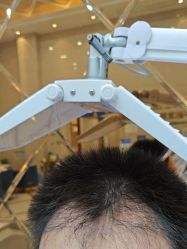 -碧莲盛·不剃发植发