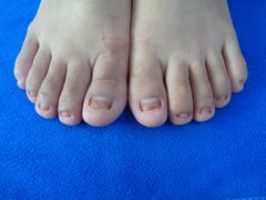 -世龙世家甲沟炎·灰指甲·嵌甲矫正·修脚(武侯区双楠店)