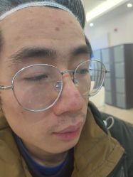 -长沙雅美医疗美容医院